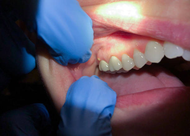 Best Same-Day Emergency Dentist in Goodwater, AL